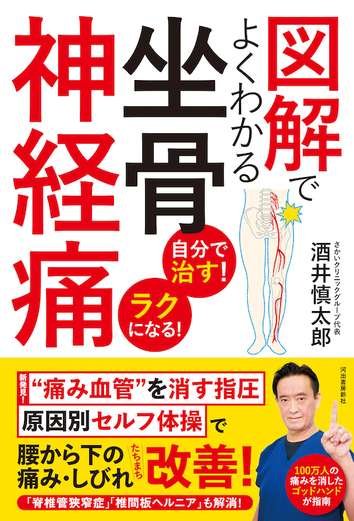 図解でよくわかる坐骨神経痛