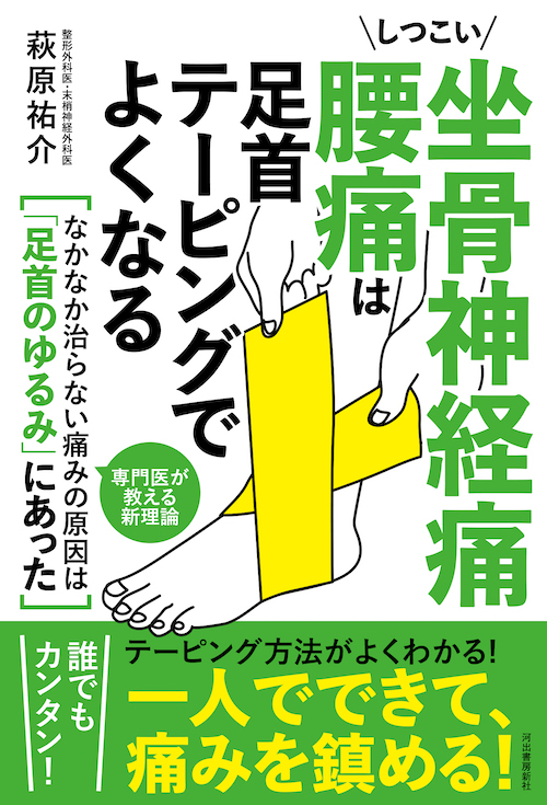 しつこい坐骨神経痛　腰痛は足首テーピングでよくなる