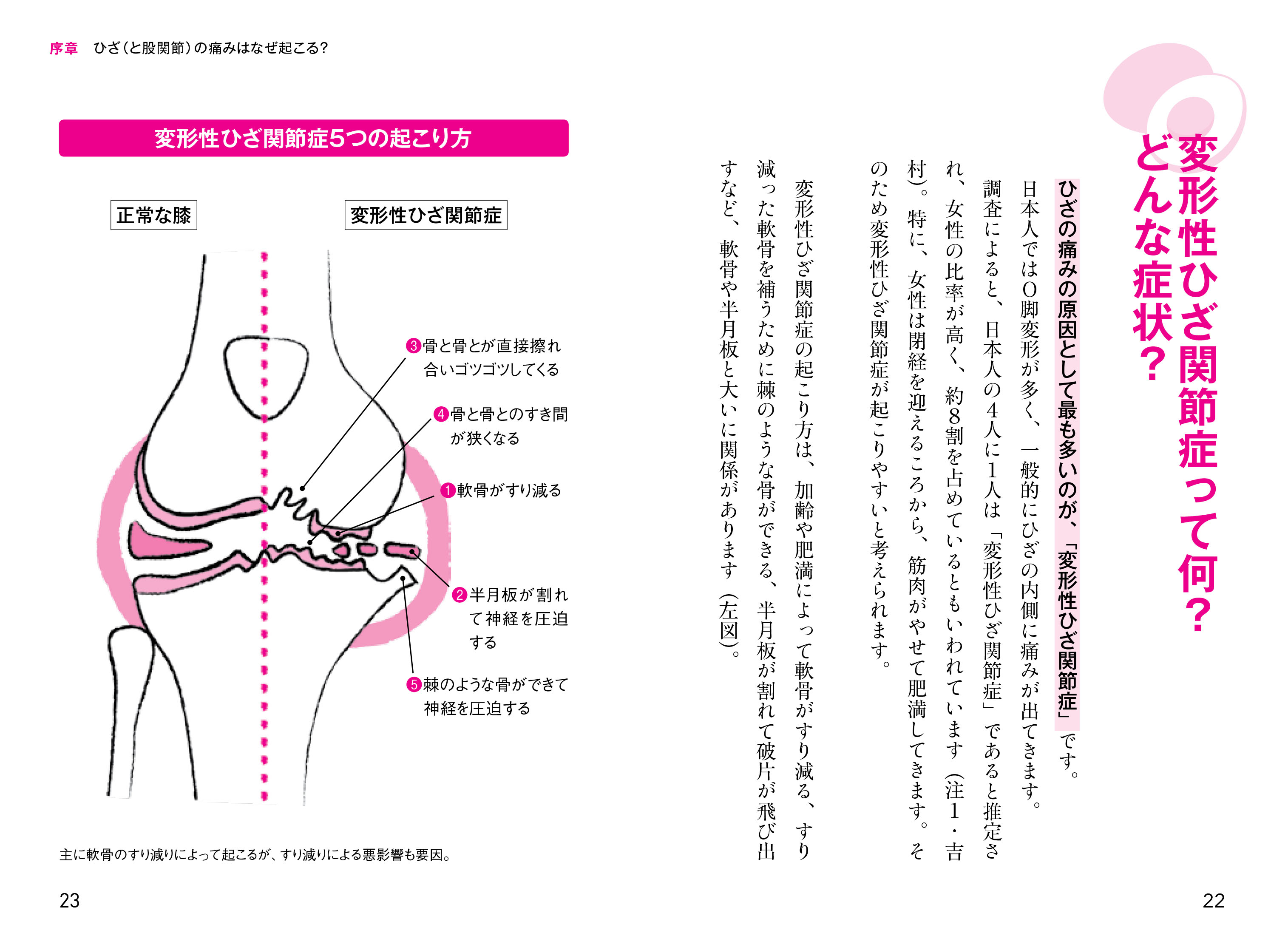 １日半分のアボカドでひざの痛みはラクになる 戸田 佳孝 河出書房新社